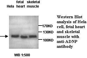 Image no. 1 for anti-Activity-Dependent Neuroprotector Homeobox (ADNP) antibody (ABIN1574495) (ADNP Antikörper)
