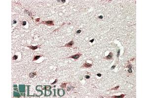 ABIN185356 (5µg/ml) staining of paraffin embedded Human Cerebral Cortex. (DYX1C1 Antikörper  (C-Term))