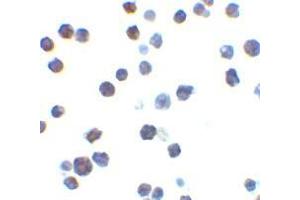 Immunocytochemistry of Bak in L1210 cells with AP30117PU-N Bak antibody at 2 μg/ml. (BAK1 Antikörper  (N-Term))