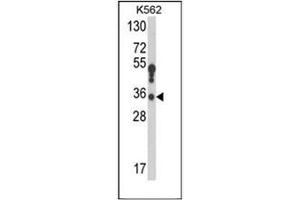 Western blot analysis of 17-beta-HSD3 / HSD17B3 Antibody (Center) in K562 cell line lysates (35ug/lane).