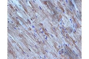 Immunohistochemistry (IHC) image for anti-Caspase 3 (CASP3) (N-Term) antibody (ABIN6260474)