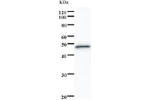 Western Blotting (WB) image for anti-SATB Homeobox 1 (SATB1) antibody (ABIN932488)