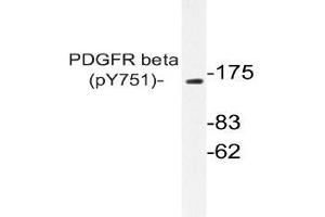 Western blot (WB) analysis of p-PDGFR beta antibody in extracts from NIH/3T3 PDGF cells . (PDGFRB Antikörper  (pTyr751))
