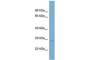 Image no. 1 for anti-Ubiquinol-Cytochrome C Reductase, Rieske Iron-Sulfur Polypeptide 1 (UQCRFS1) (N-Term) antibody (ABIN6741954) (UQCRFS1 Antikörper  (N-Term))