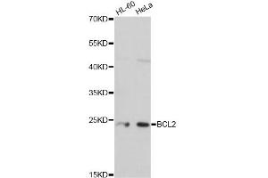 Western blot analysis of extracts of various cell lines, using BCL2 antibody. (Bcl-2 Antikörper)