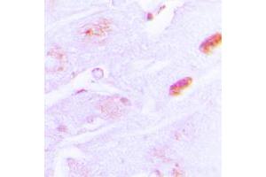 Immunohistochemical analysis of Amylin staining in human brain formalin fixed paraffin embedded tissue section.