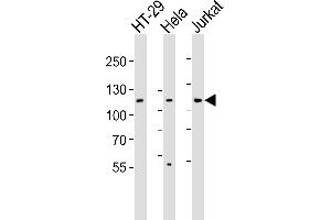 Western blot analysis of lysates from HT-29, Hela, Jurkat cell line (from left to right), using JAK1 Antibody (N-term) (ABIN6242901 and ABIN6577480). (JAK1 Antikörper  (N-Term))
