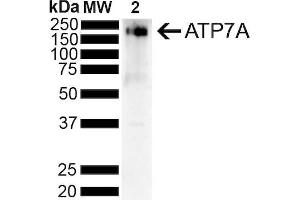 Western Blotting (WB) image for anti-ATPase, Cu++ Transporting, alpha Polypeptide (ATP7A) (AA 42-61) antibody (ABIN1027714)
