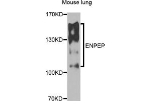 Western blot analysis of extracts of mouse lung, using ENPEP antibody (ABIN5975067) at 1/1000 dilution. (ENPEP Antikörper)