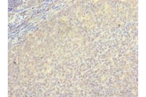 Immunohistochemistry of paraffin-embedded human tonsil tissue using ABIN7145628 at dilution of 1:100 (LOH12CR1 Antikörper  (AA 1-196))