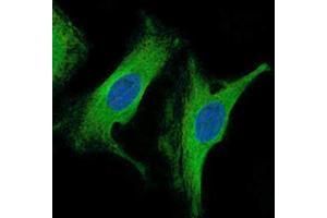 Immunofluorescence analysis of HeLa cells using β-tubulin antibody (green). (TUBB Antikörper)