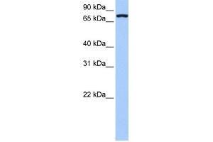 WB Suggested Anti-NLGN4X Antibody Titration:  0. (Neuroligin 4 Antikörper  (Middle Region))