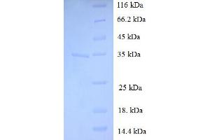 SDS-PAGE (SDS) image for Chromosome 19 Open Reading Frame 33 (C19ORF33) (AA 1-85), (Isoform 2) protein (GST tag) (ABIN5709161)