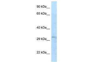Western Blot showing TIPRL antibody used at a concentration of 1 ug/ml against 721_B Cell Lysate (TIPRL Antikörper  (N-Term))