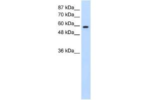 WB Suggested Anti-DAZ2 Antibody Titration:  0. (DAZ2 Antikörper  (N-Term))