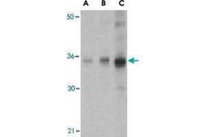 Western blot analysis of SOCS1 in human spleen tissue lysate with SOCS1 polyclonal antibody  at (A) 1, (B) 2 and (C) 4 ug/mL .