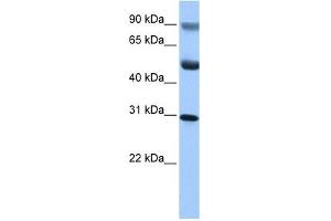 C17ORF39 antibody used at 1 ug/ml to detect target protein. (GID4 Antikörper  (C-Term))