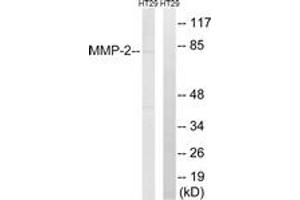 Western blot analysis of extracts from HT-29 cells, using MMP-2 Antibody. (MMP2 Antikörper  (AA 611-660))