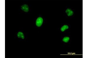 Immunofluorescence of purified MaxPab antibody to VRK1 on HeLa cell.
