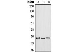 Western blot analysis of ARF6 expression in HeLa (A), mouse liver (B), rat spleen (C) whole cell lysates. (ARF6 Antikörper  (Center))