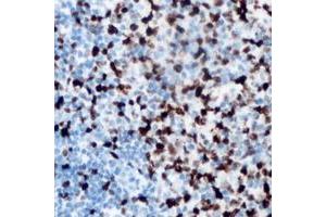 Immunohistochemical analysis of ANKRD1 staining in human lymph node formalin fixed paraffin embedded tissue section. (ANKRD1 Antikörper  (C-Term))
