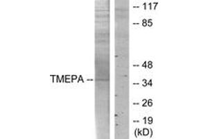 Western blot analysis of extracts from HT-29 cells, using TMEPA Antibody. (TMEPA (AA 101-150) Antikörper)