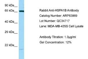 Western Blotting (WB) image for anti-Heat Shock 70kDa Protein 1B (HSPA1B) (C-Term) antibody (ABIN2789650)