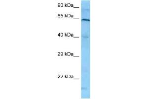 WB Suggested Anti-PLK1 Antibody   Titration: 1.