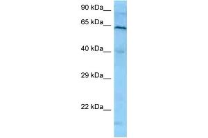 WB Suggested Anti-PLK1 Antibody   Titration: 1. (PLK1 Antikörper  (N-Term))