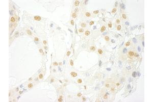 anti-Serine/threonine-Protein Kinase PRP4 Homolog (PRPF4B) (AA 1-50) antibody