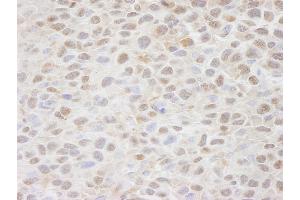 Immunohistochemistry (IHC) image for anti-CSE1 Chromosome Segregation 1-Like (CSE1L) (AA 1-50) antibody (ABIN7448490) (Exportin 2 Antikörper  (AA 1-50))
