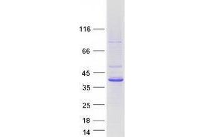 Western Blotting (WB) image for Tropomodulin 2 (TMOD2) (Transcript Variant 2) protein (Myc-DYKDDDDK Tag) (ABIN2734379)