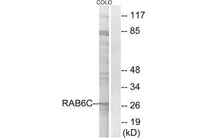Western Blotting (WB) image for anti-RAB6C (WTH3DI) (Internal Region) antibody (ABIN1851986) (WTH3DI Antikörper  (Internal Region))