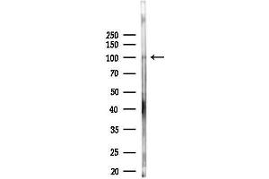anti-Scm-Like with Four Mbt Domains 2 (SFMBT2) antibody