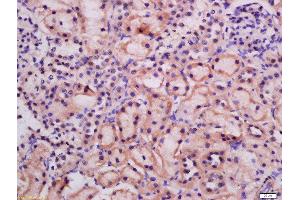 Formalin-fixed and paraffin embedded rat kidney labeled with Rabbit Anti-ATG9A Polyclonal Antibody, Unconjugated  at 1:200 followed by conjugation to the secondary antibody and DAB staining (ATG9A Antikörper  (AA 301-400))