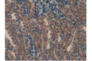 IHC-P analysis of Rat Kidney Tissue, with DAB staining. (aHSP Antikörper  (AA 2-102))
