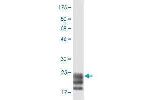 Western Blot detection against Immunogen (22 KDa) . (TNFSF15 Antikörper  (AA 72-251))