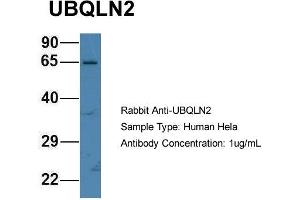 Host: Rabbit Target Name: UBQLN2 Sample Type: Hela Antibody Dilution: 1. (Ubiquilin 2 Antikörper  (N-Term))