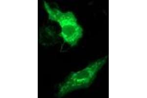 Immunofluorescence (IF) image for anti-Methylmalonic Aciduria (Cobalamin Deficiency) CblB Type (MMAB) antibody (ABIN1499507) (MMAB Antikörper)