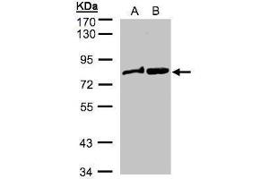 WB Image Sample(30 ug whole cell lysate) A: MOLT4 , B: Raji , 7. (DVL2 Antikörper  (Internal Region))