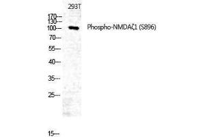 Western Blotting (WB) image for anti-Glutamate Receptor, Ionotropic, N-Methyl D-Aspartate 1 (GRIN1) (pSer896) antibody (ABIN3173254) (GRIN1/NMDAR1 Antikörper  (pSer896))