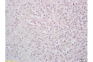 Formalin-fixed and paraffin embedded mouse embryo labeled with Rabbit Anti StAR/StARD1 Polyclonal Antibody, Unconjugated (ABIN700960) at 1:200 followed by conjugation to the secondary antibody and DAB staining