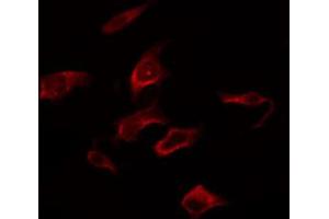 ABIN6267281 staining Hela by IF/ICC. (RAF1 Antikörper  (pSer259))