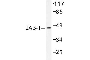Image no. 1 for anti-COP9 Signalosome Complex Subunit 3 (COPS3) antibody (ABIN265485) (COPS3 Antikörper)