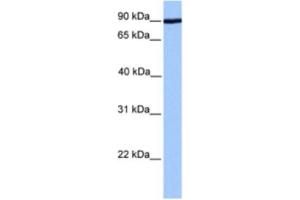 Western Blotting (WB) image for anti-ADAM Metallopeptidase Domain 2 (ADAM2) antibody (ABIN2463573) (ADAM2 Antikörper)