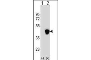 Western blot analysis of PECI (arrow) using rabbit polyclonal PECI Antibody (C-term) (ABIN652636 and ABIN2842426). (PECI/ECI2 Antikörper  (C-Term))