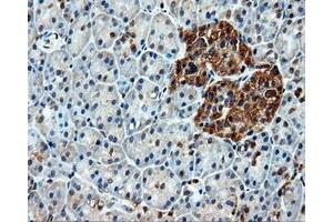 Immunohistochemical staining of paraffin-embedded liver tissue using anti-HSPA1Amouse monoclonal antibody. (HSP70 1A Antikörper)