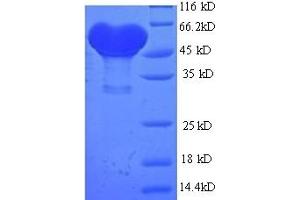 SDS-PAGE (SDS) image for Alcohol Dehydrogenase 1B (Class I), beta Polypeptide (ADH1B) (AA 2-375) protein (His-SUMO Tag) (ABIN4975998)
