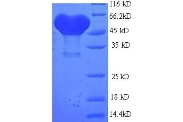 ADH1B Protein (AA 2-375) (His-SUMO Tag)