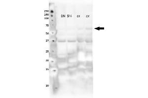 Lanes : Lane 1: Nuclear fraction from mouse substantia nigra Lane 2: Nuclear fraction from mouse substantia nigra Lane 3: Nuclear fraction from mouse cortex Lane 4: Nuclear fraction from mouse cortex Primary Antibody Dilution :  1:400   Secondary Antibody : Goat anti rabbit-HRP  Secondary Antibody Dilution :  1:10,000  Gene Name : NR4A2  Submitted by : Sorce Silvia, University of Zurich (NR4A2 Antikörper  (N-Term))